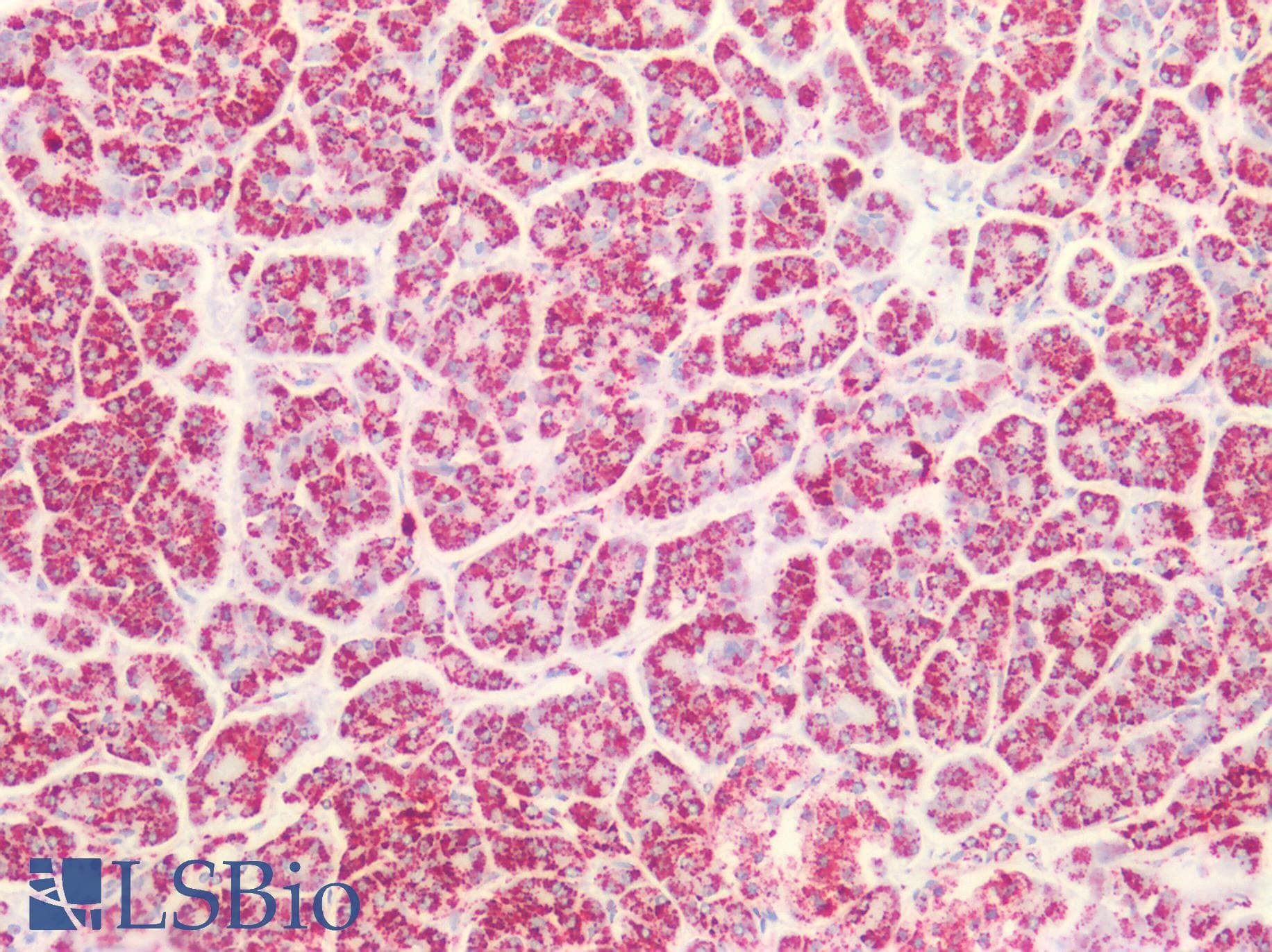 PathPlus™ PVR / CD155 Antibody (aa314-342)