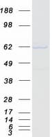 Human ABI2B / ABI2 Protein (Recombinant Myc-DDK (Flag))