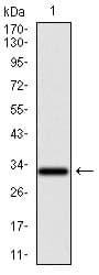 NR6A1 / GCNF Antibody (clone 4G8)