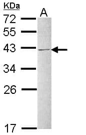 HNRNPC / HNRNP C Antibody (aa1-142)