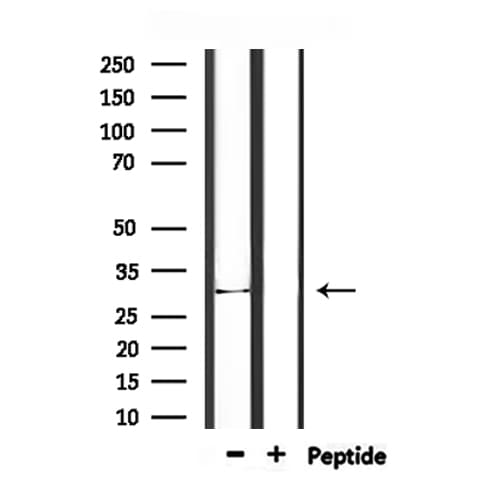 Polyclonal Rabbit anti-Human IL1A / IL-1 Alpha Antibody (IHC, WB)