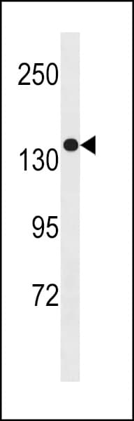 SGSM1 Antibody (aa624-652)