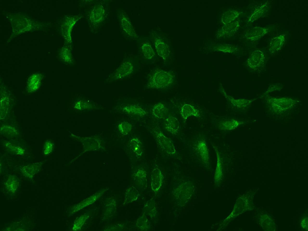 MRPS25 Antibody
