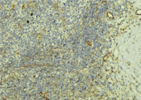 KISS1R / GPR54 Antibody