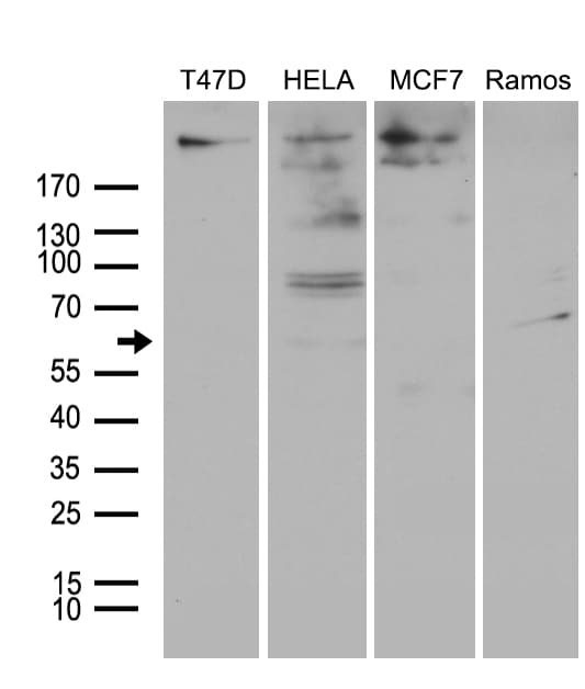 MTA3 Antibody (aa1-259, clone OTI2B8)