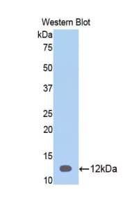 SERPINA12 / Vaspin Antibody (aa52-143)