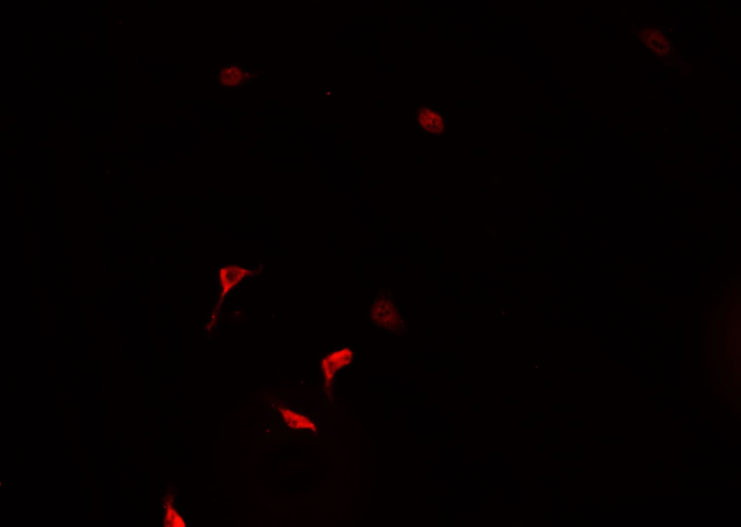 Polyclonal Rabbit anti-Human ZNF187 Antibody (IF, WB)