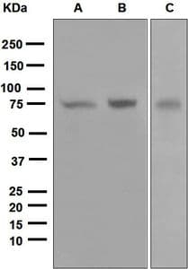 IHC-plus™ Monoclonal Rabbit anti-Human PRKCZ / PKC-Zeta Antibody (clone EP1490(2), Internal, IHC, WB)