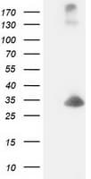 DCK / Deoxycytidine kinase Antibody (clone OTI3F5)