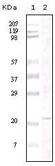 FAK / Focal Adhesion Kinase Antibody (clone 4A9D6)