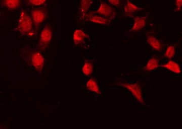 RELA / NFKB p65 Antibody (phospho-Ser468)