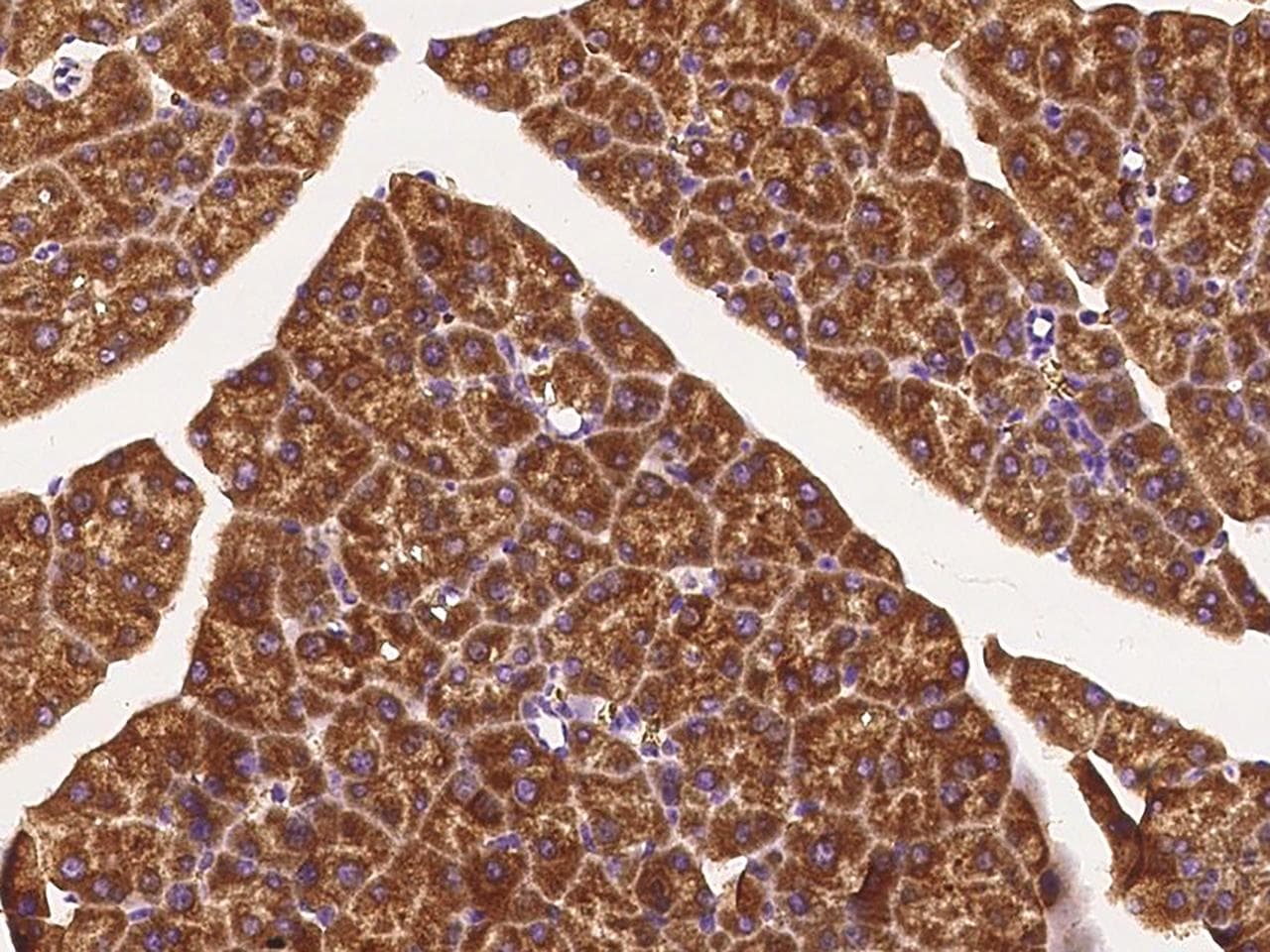 ANGPTL4 Antibody (Preservative Free)