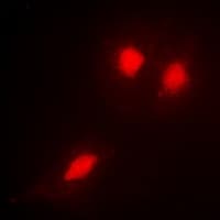 TSG101 Antibody