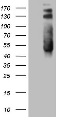 TWF1 / PTK9 Antibody (aa140-384, clone OTI5C12)