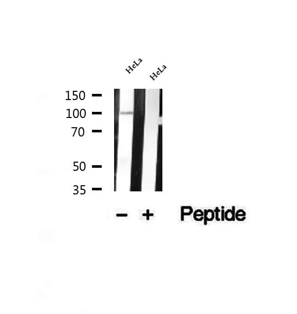 Polyclonal Rabbit anti-Human PARP13 / ZC3HAV1 Antibody (IHC, WB)