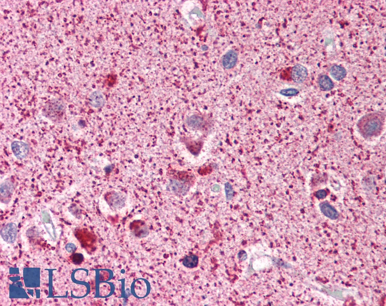 IHC-plus™ Polyclonal Rabbit anti-Human NF2 / Merlin Antibody (phospho-Ser518, IHC, WB)