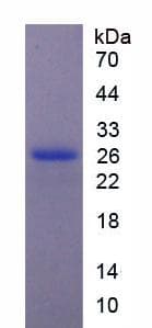 Rat CEACAM5 / CD66e Protein (Recombinant His, N-Terminal)