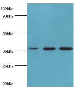 Polyclonal Rabbit anti-Human GLRX3 / Glutaredoxin 3 Antibody (aa1-335, IHC, WB)