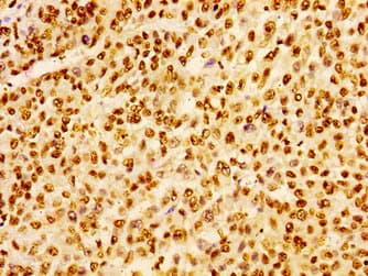 HIST1H1B Antibody