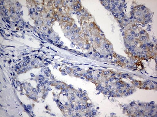 PLOD2 Antibody (aa359-640, clone OTI7G5)