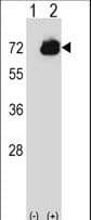 Polyclonal Rabbit anti-Human CTP Synthetase 2 / CTPS2 Antibody (aa450-479, WB)