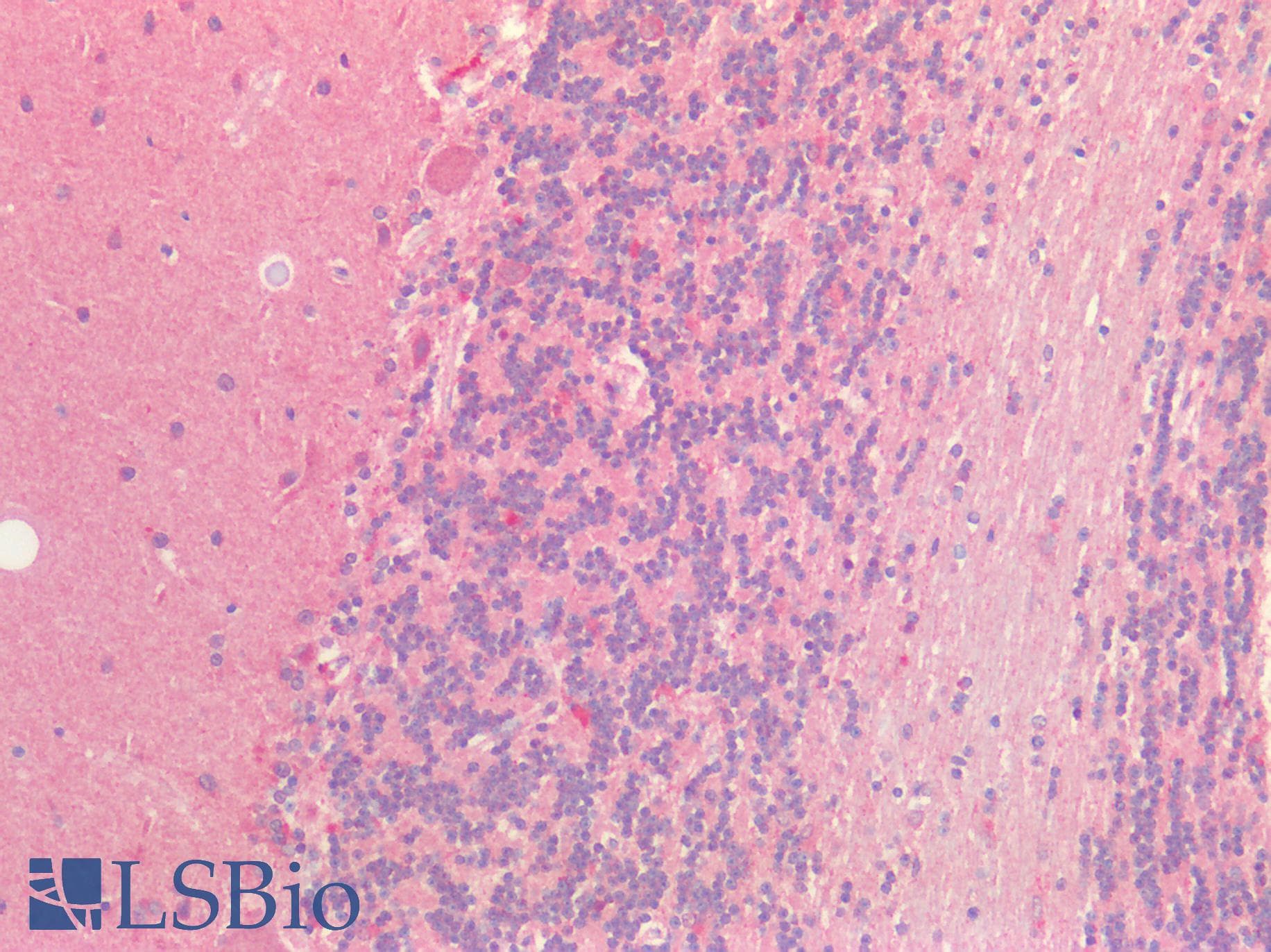 PathPlus™ TUBB / Beta Tubulin Antibody (aa174-428)