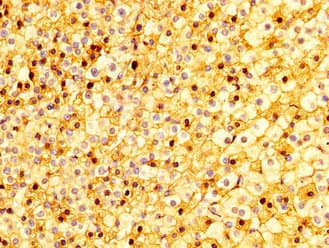 Polyclonal Rabbit anti-Human SEMA4B / Semaphorin 4B Antibody (IHC, WB)