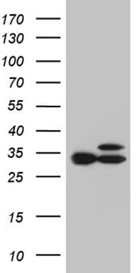 Monoclonal Mouse anti-Human RPL7A / Ribosomal Protein L7a Antibody (clone OTI4C1, Carrier-free, aa2-266, WB)