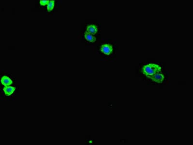 ZNF365 Antibody