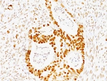 TP53 / p53 Antibody (clone TRP/817, Ready-to-Use)