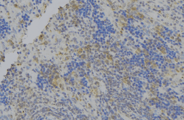 Apg7 / ATG7 Antibody