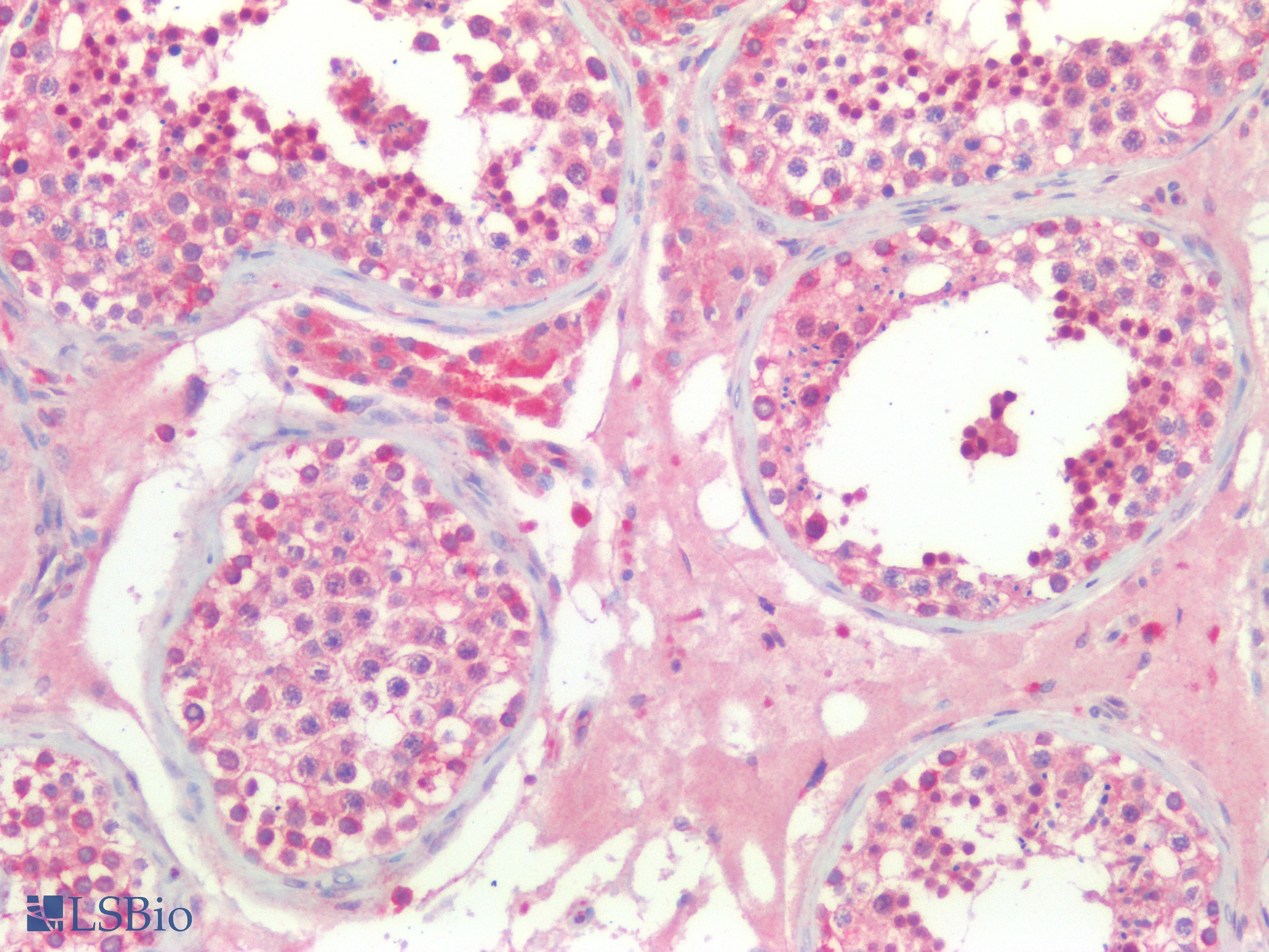PathPlus™ TJP1 / ZO-1 Antibody