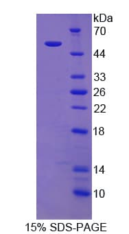 Rat MUC20 Protein (Recombinant His-GST)