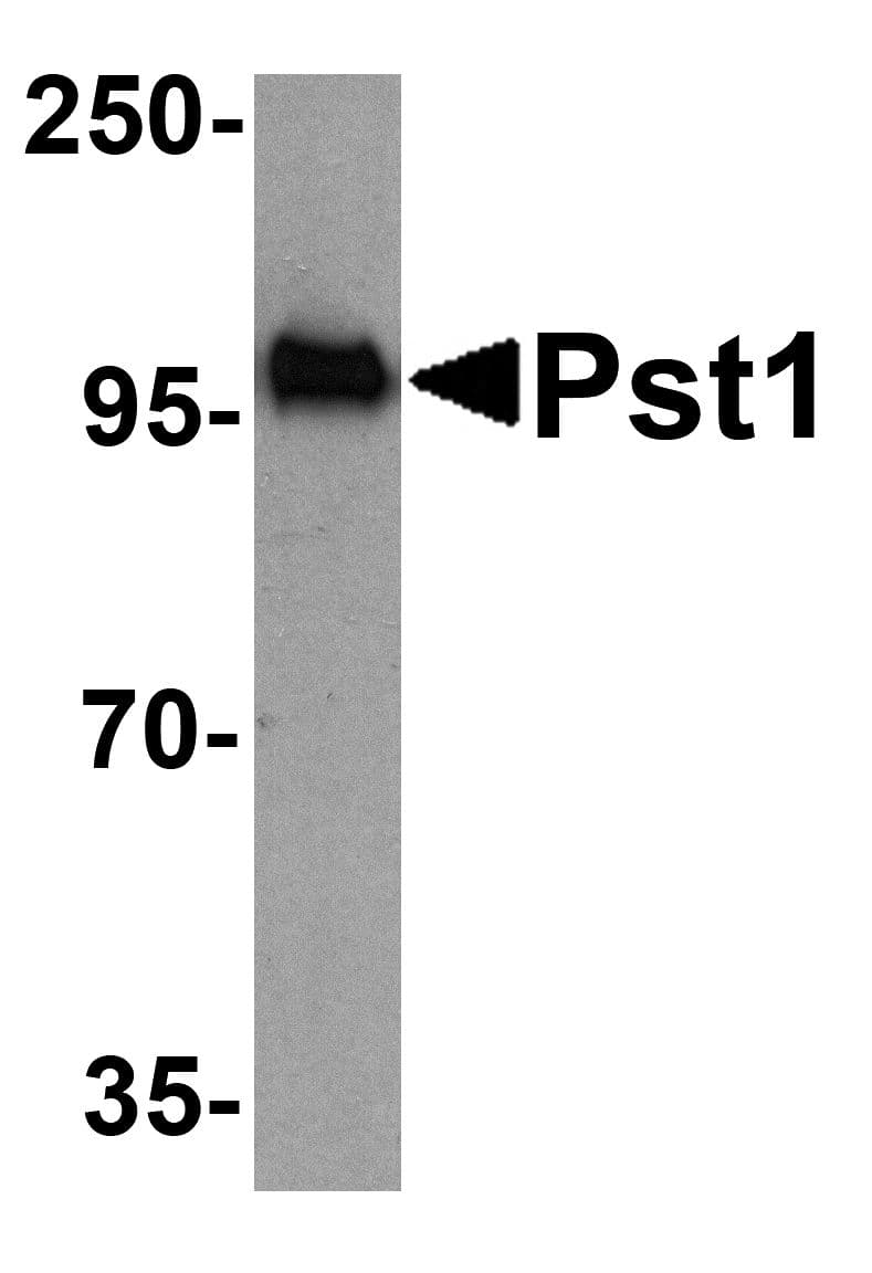 NT5C3B / NT5C3L Antibody