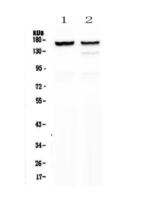 MYBPC3 / MYBP-C Antibody (aa1070-1123)