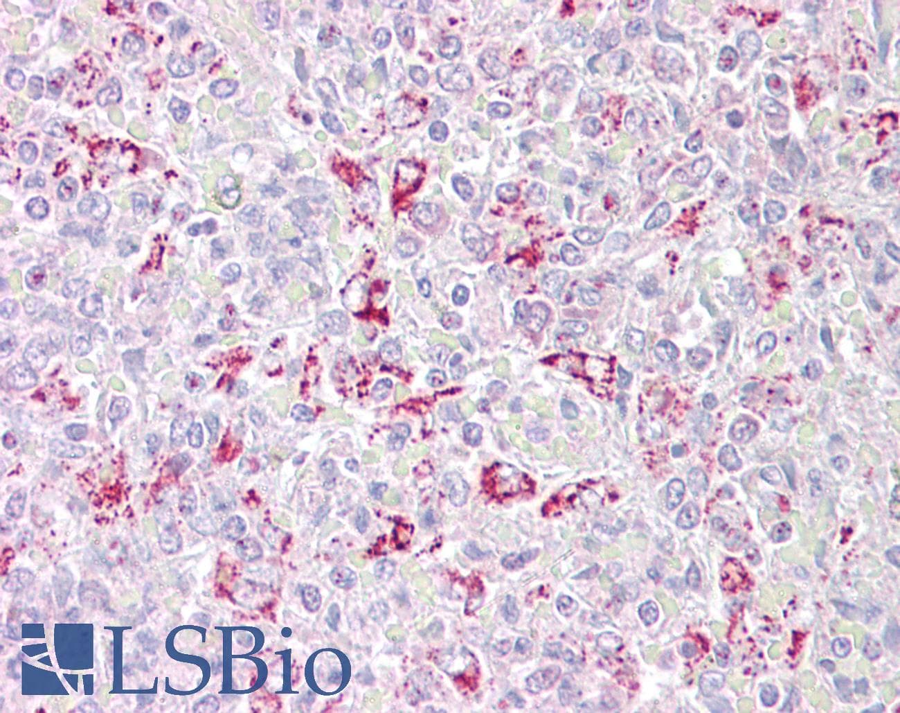 IHC-plus™ PFKFB2 Antibody (aa7-19)