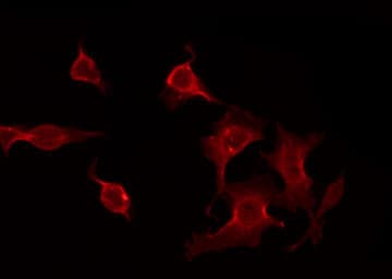 Polyclonal Rabbit anti-Human CACNG7 Antibody (IF, WB)