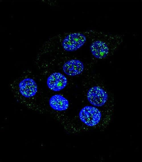 CCDC36 Antibody (aa422-450)