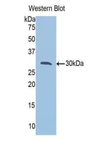 VAP33 / VAPA Antibody (aa1-249, PE)