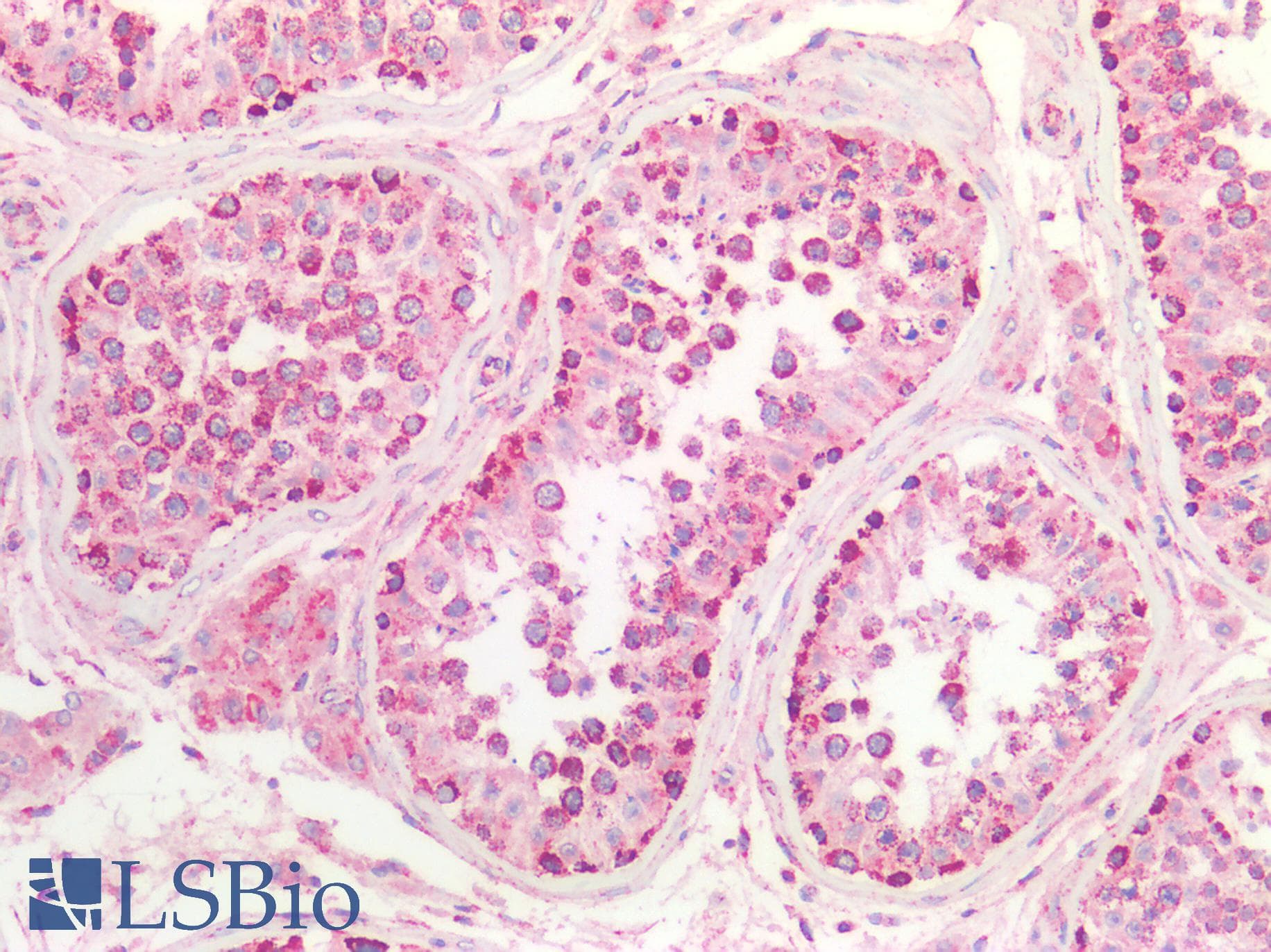 PathPlus™ SSBP1 / mtSSB Antibody