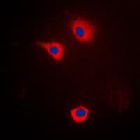 CYP2U1 Antibody (Internal)