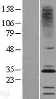 CMTM2 Protein (Over-Expression Lysate Myc-DDK (Flag))