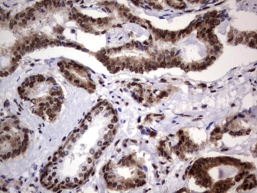 Monoclonal Mouse anti-Human DDX56 Antibody (clone UMAB152, Carrier-free, aa323-547, IHC, IF, WB)