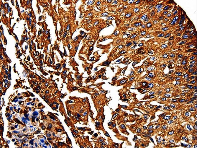 PKM / Pyruvate Kinase, Muscle Antibody