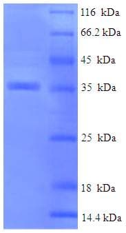 Human CRYAB / Alpha B Crystallin Protein (Recombinant His-SUMO)
