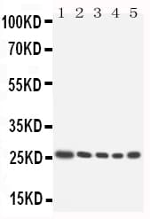 HOXA6 Antibody (aa95-114)