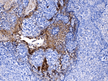 PPL / Periplakin Antibody