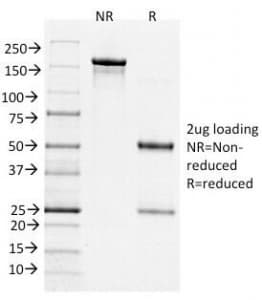 Monoclonal Mouse anti-Human BCL6 Antibody (clone BCL6/1526, IHC, IF)
