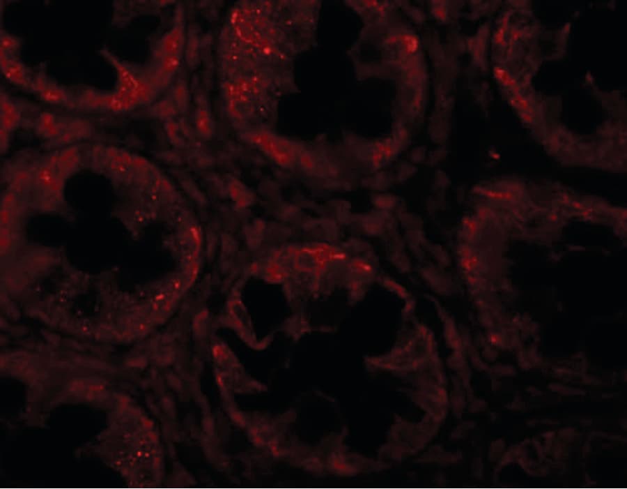 Polyclonal Rabbit anti-Human SLAMF1 / SLAM / CD150 Antibody (IHC, IF, WB)