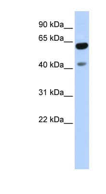 ZNF641 Antibody (aa143-192)